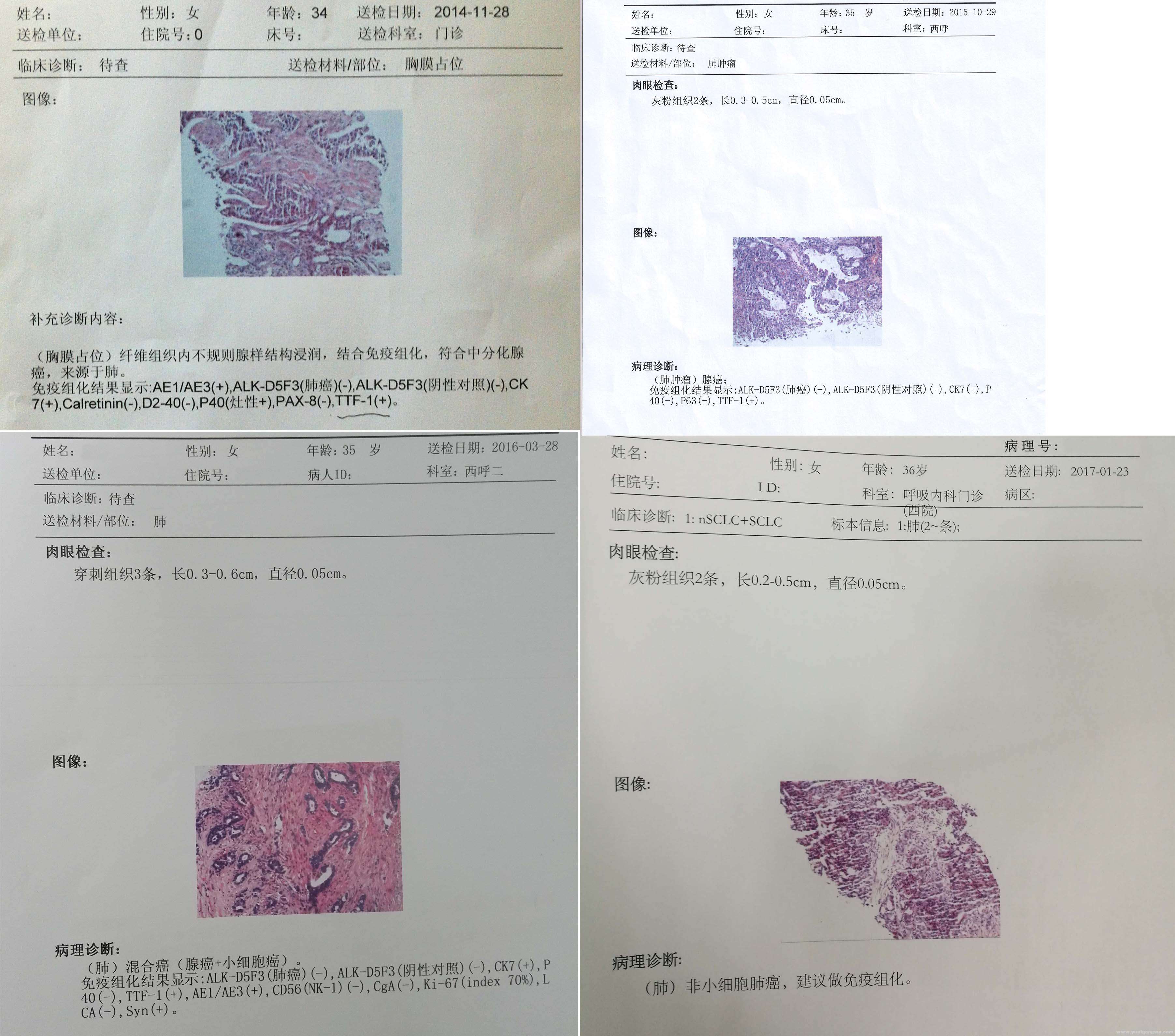 病理报告