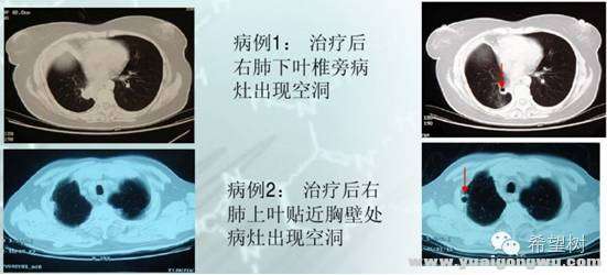 小分子抗血管3.jpg