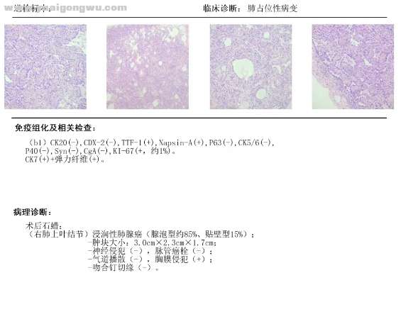病理报告03